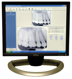 Digital Dental X-rays Meriden CT